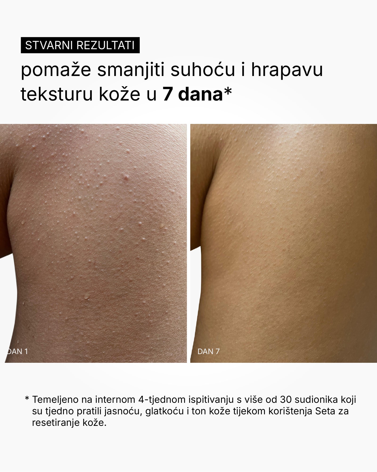 Skin Reset Set - Full Body Routine